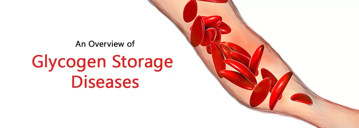 An Overview of Glycogen Storage Diseases